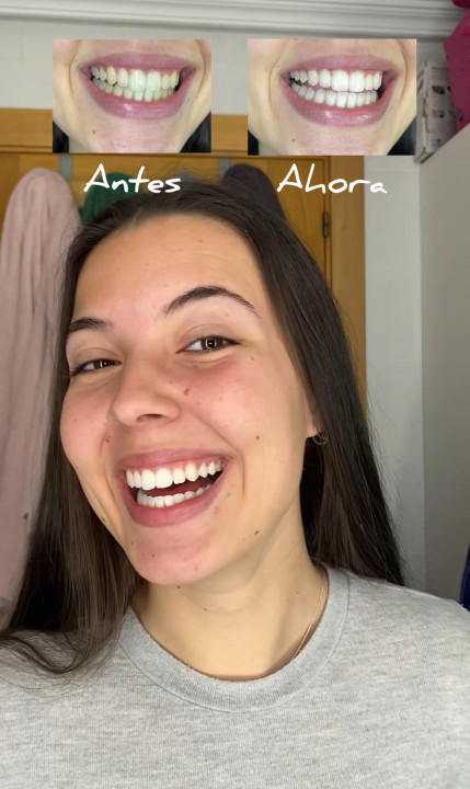 María José — Antes y Ahora con V34