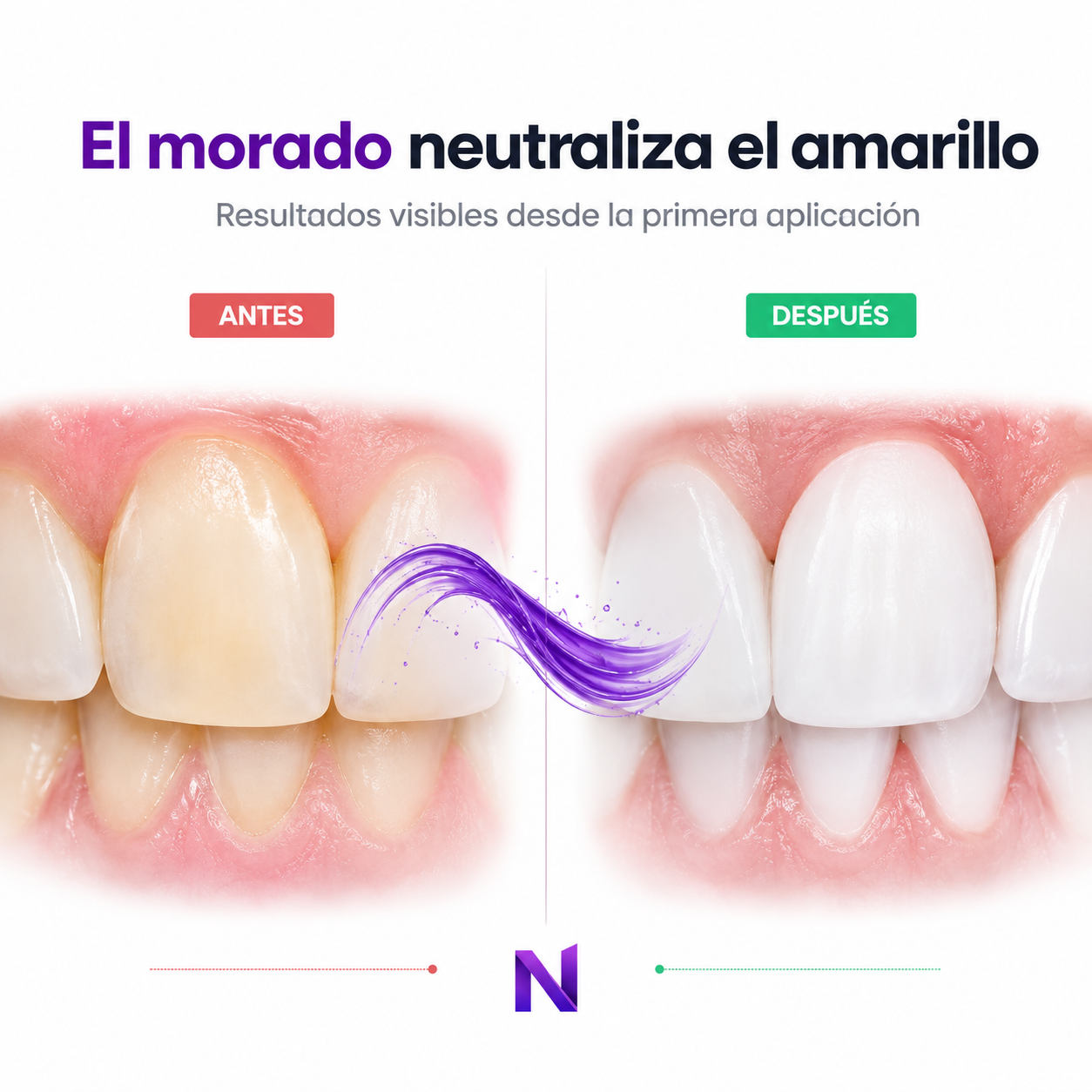 V34 Antes y Después — El morado neutraliza el amarillo